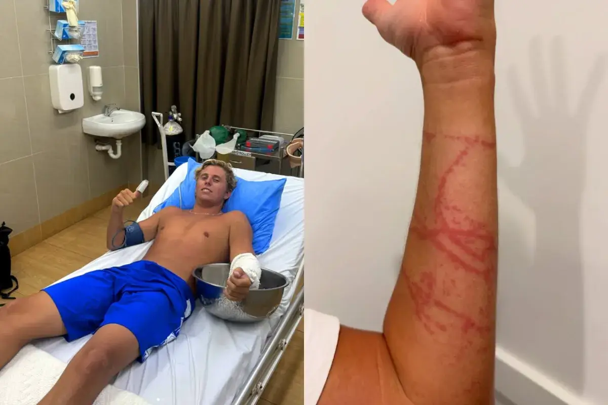Cloudbreak : le récit terrifiant d’un surfeur face à la méduse la plus venimeuse au monde