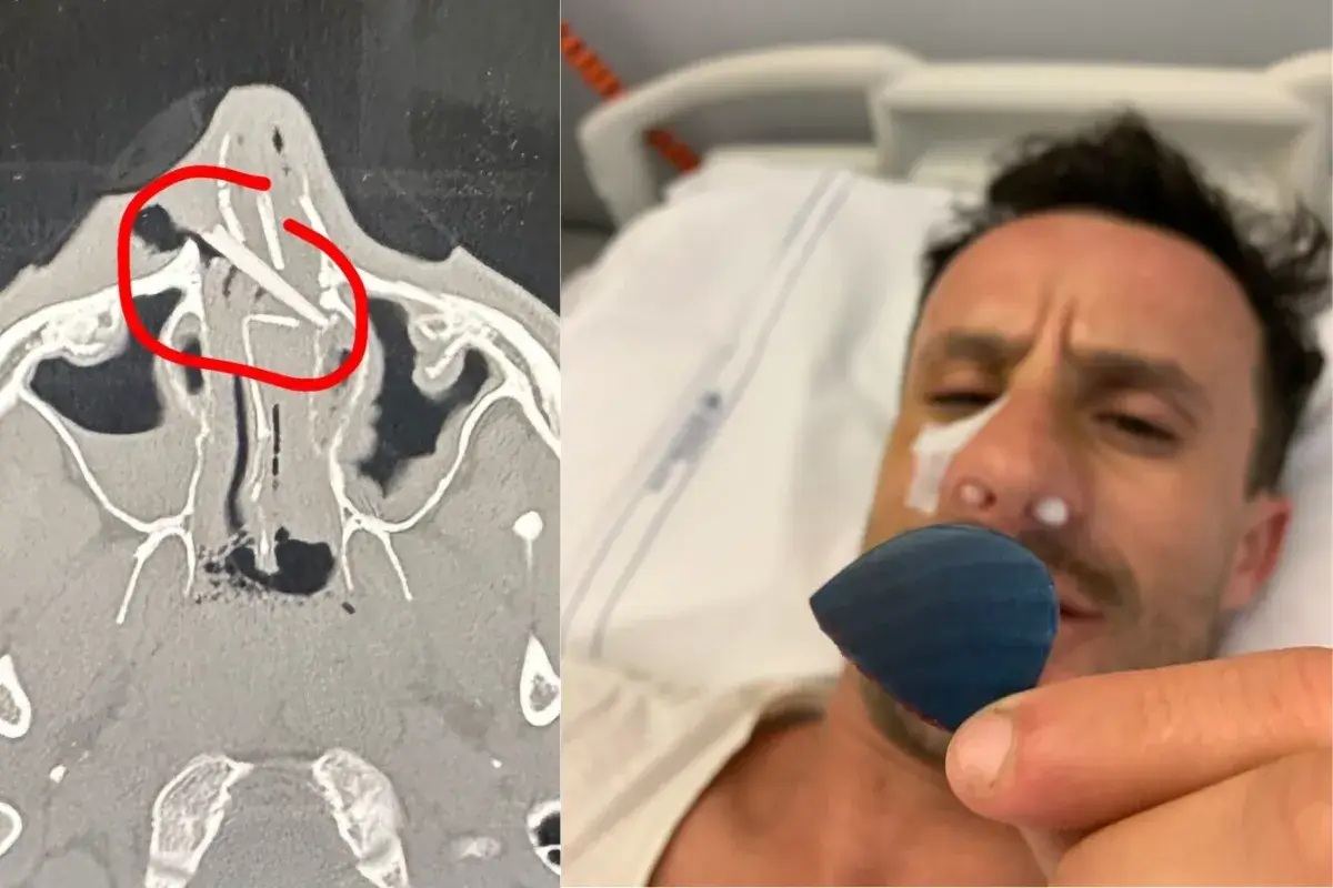 « Je ne savais pas qu&rsquo;une partie de ma planche était encore en moi » : l&rsquo;histoire folle de Davide Lopez
