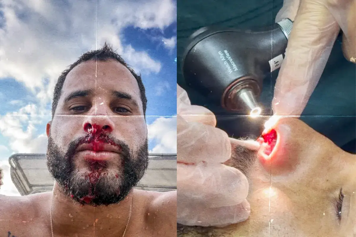 Fiji Pro 2026 : touché au visage à Cloudbreak, Italo Ferreira assure sa qualification au round 3